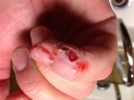 sliced finger.jpg