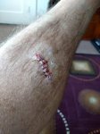 stitches in leg.jpg